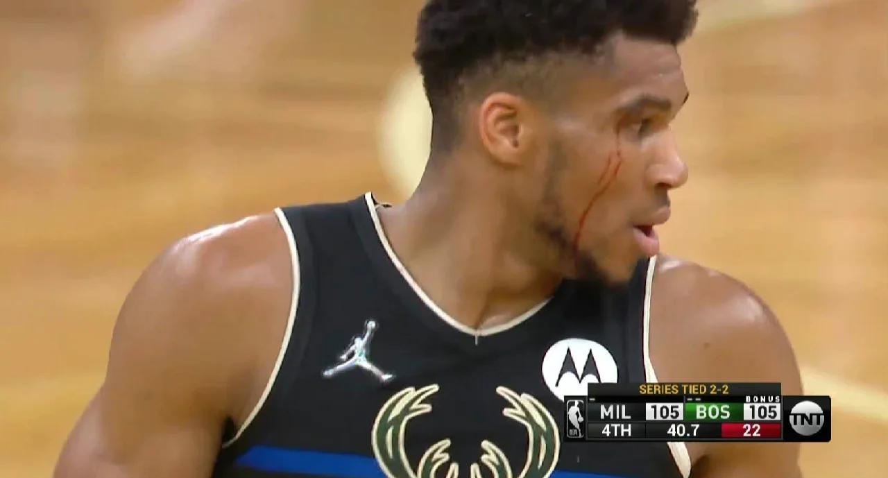 关于雄鹿队核心球员受伤成疑眼下尚未清楚的信息 关于雄鹿队核心球员受伤成疑眼下尚未清楚的信息